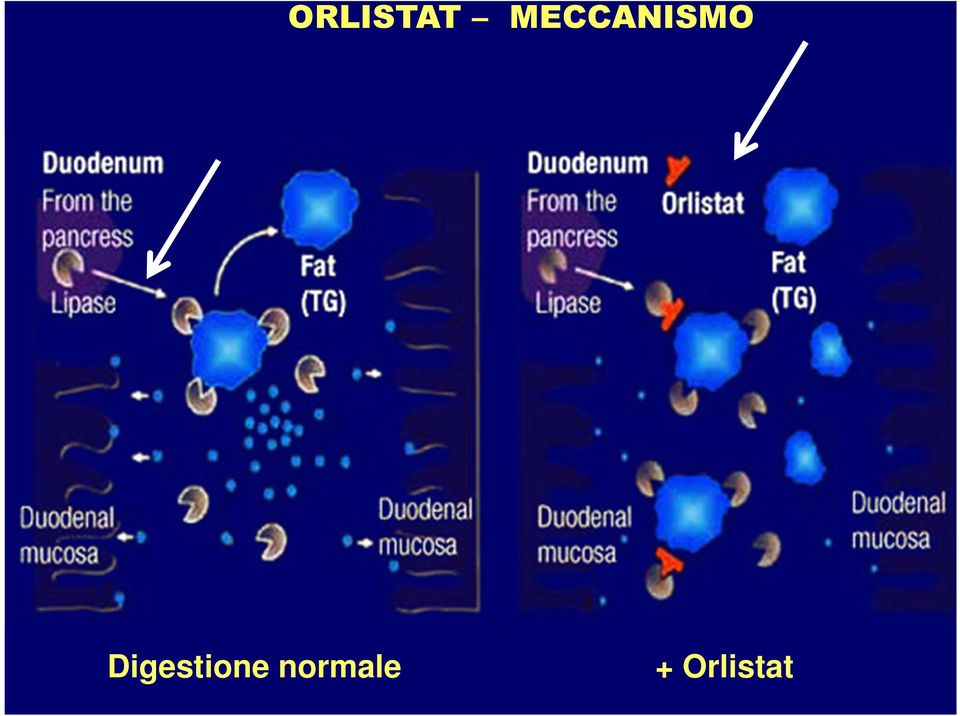 Digestione