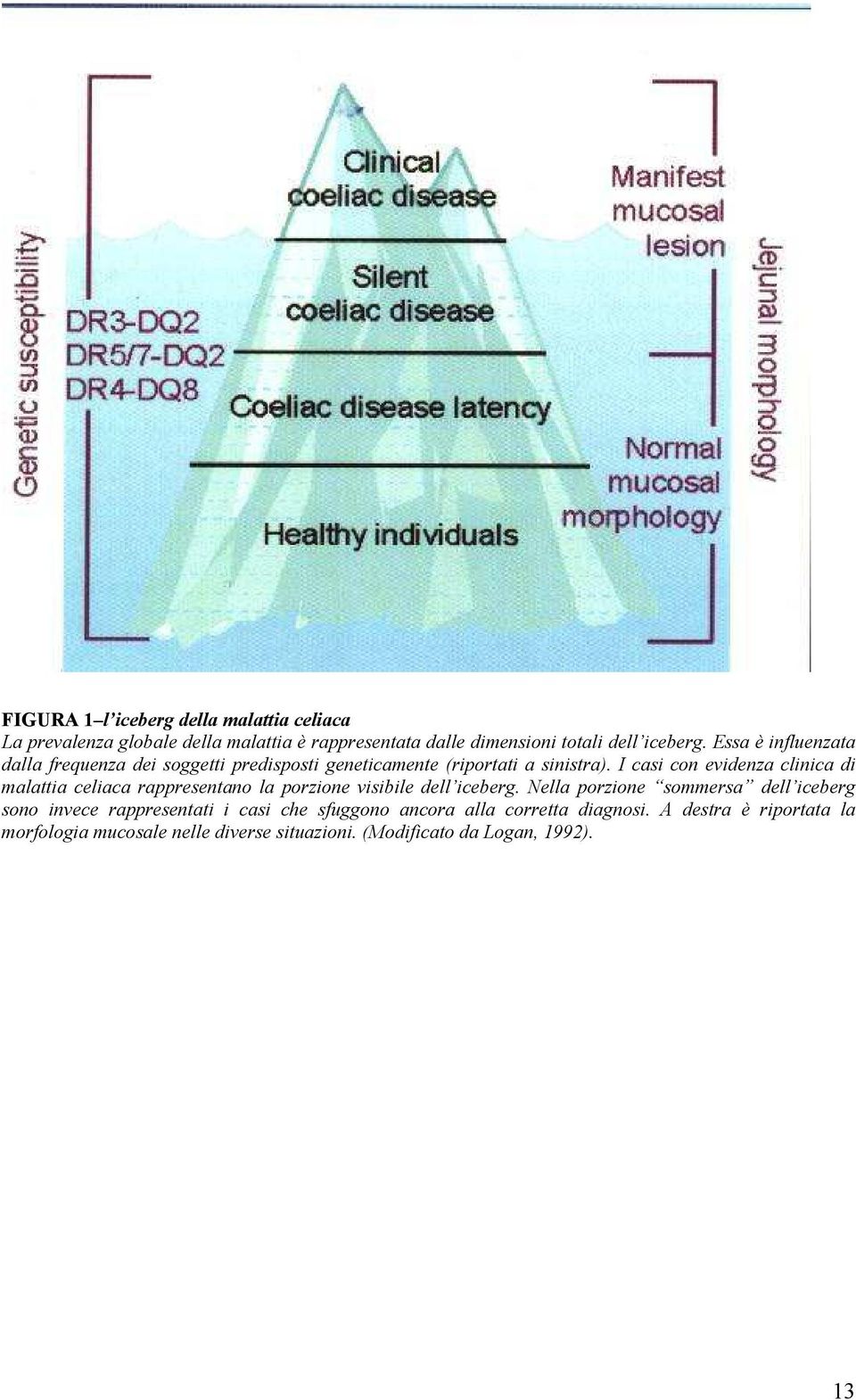 I casi con evidenza clinica di malattia celiaca rappresentano la porzione visibile dell iceberg.