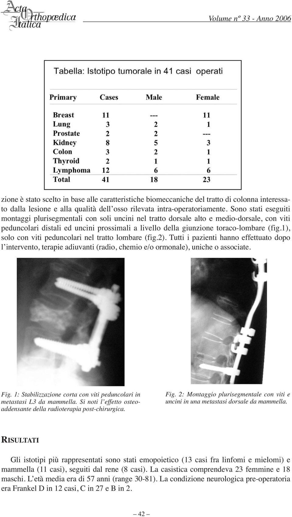 1), solo con viti peduncolari nel tratto lombare (fig.2). Tutti i pazienti hanno effettuato dopo l intervento, terapie adiuvanti (radio, chemio e/o ormonale), uniche o associate. Fig.