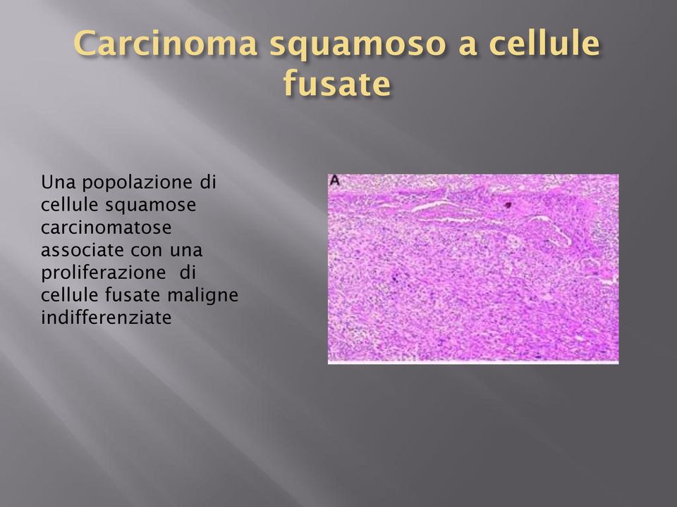 carcinomatose associate con una