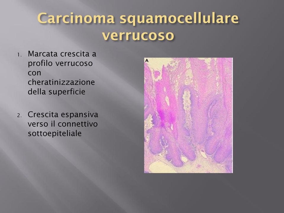 cheratinizzazione della superficie