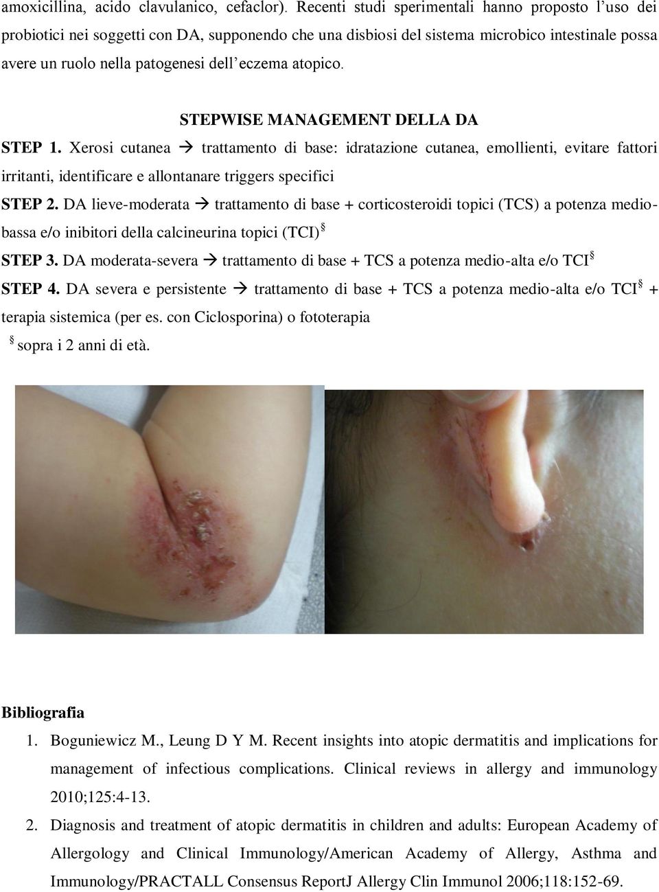 atopico. STEPWISE MANAGEMENT DELLA DA STEP 1. Xerosi cutanea trattamento di base: idratazione cutanea, emollienti, evitare fattori irritanti, identificare e allontanare triggers specifici STEP 2.