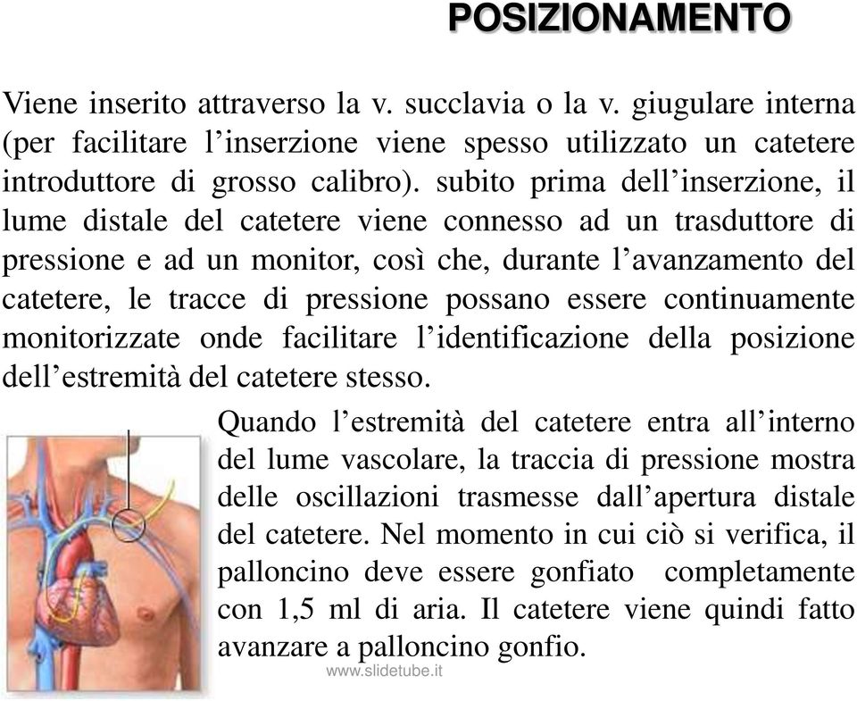 essere continuamente monitorizzate onde facilitare l identificazione della posizione dell estremità del catetere stesso.