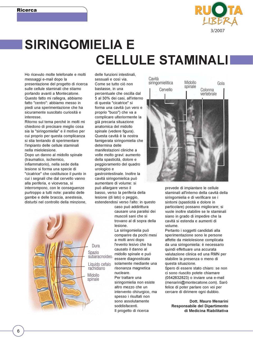 Ritorno sul tema perché in molti mi chiedono di precisare meglio cosa sia la "siringomielia" e il motivo per cui proprio per questa complicanza si stia tentando di sperimentare l'impianto delle