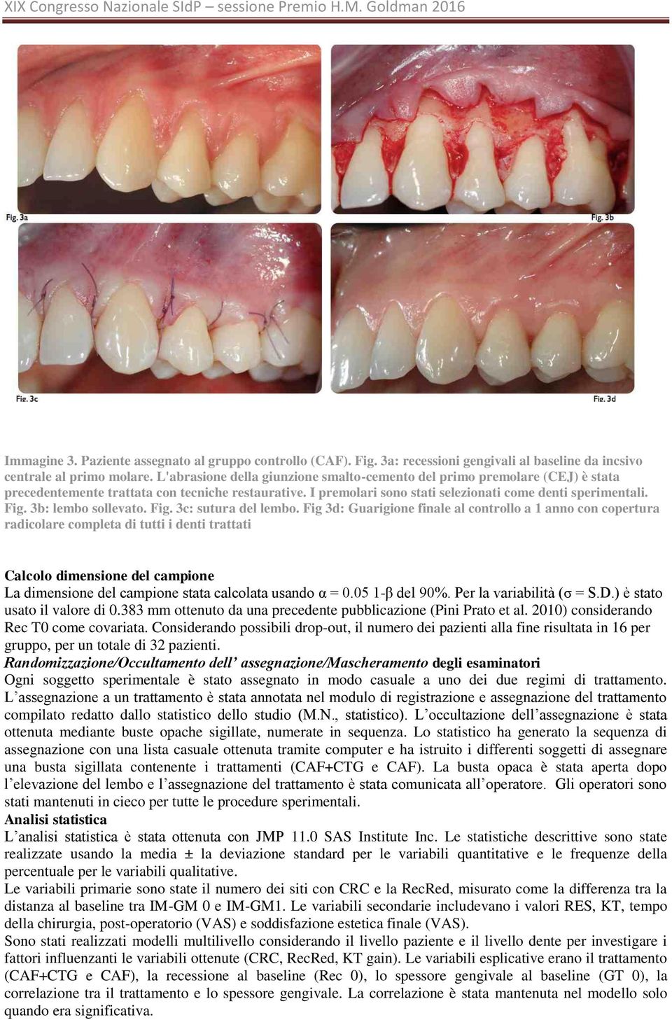 3b: lembo sollevato. Fig. 3c: sutura del lembo.