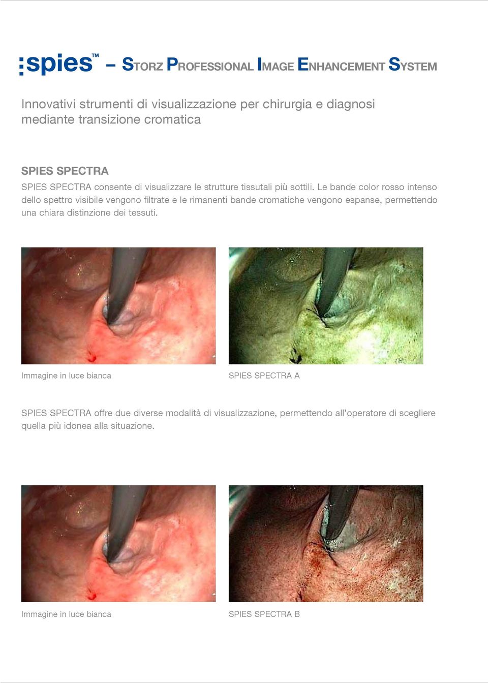 Le bande color rosso intenso dello spettro visibile vengono filtrate e le rimanenti bande cromatiche vengono espanse, permettendo una chiara distinzione