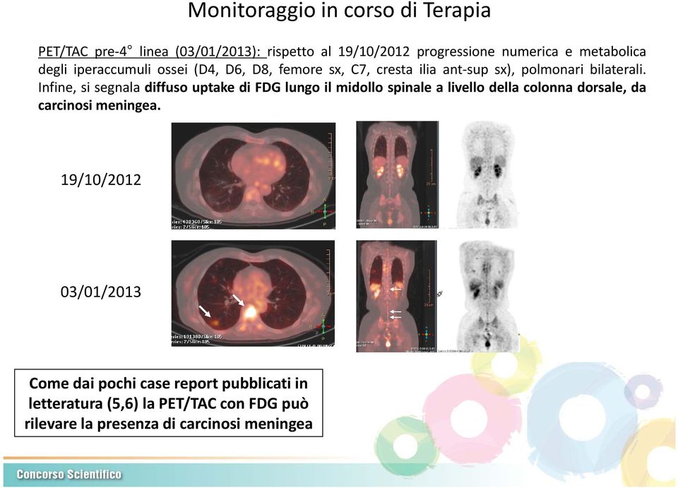 Infine, si segnala diffuso uptake di FDG lungo il midollo spinale a livello della colonna dorsale, da carcinosi