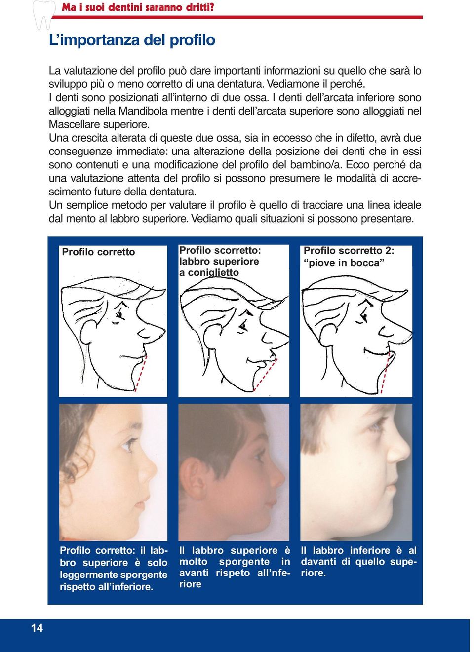 I denti dell arcata inferiore sono alloggiati nella Mandibola mentre i denti dell arcata superiore sono alloggiati nel Mascellare superiore.