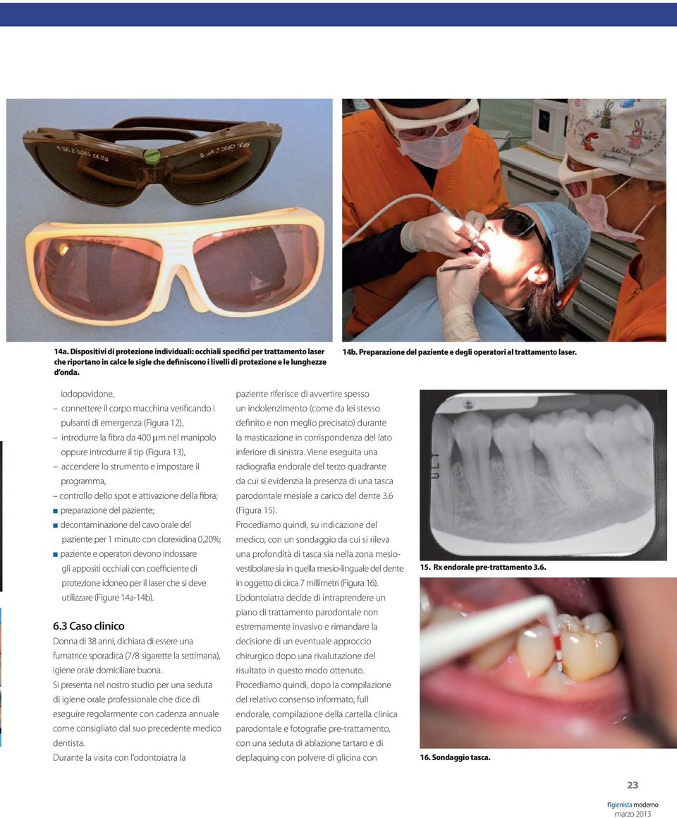 iodopovidone, connettere il corpo macchina verificando i pulsanti di emergenza (Figura 12), introdurre la fibra da 400 m nel manipolo oppure introdurre il tip (Figura 13), accendere lo strumento e