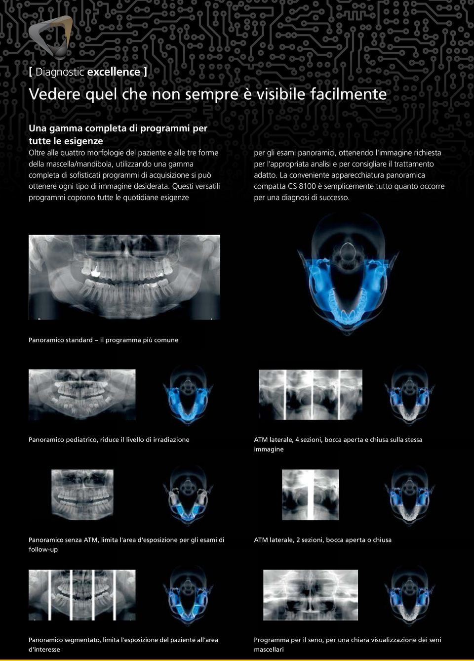 Questi versatili programmi coprono tutte le quotidiane esigenze per gli esami panoramici, ottenendo l'immagine richiesta per l'appropriata analisi e per consigliare il trattamento adatto.