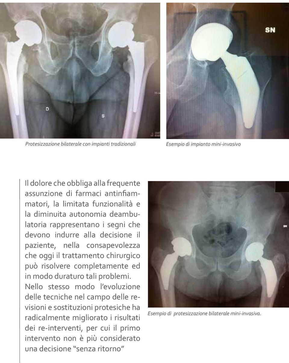 chirurgico può risolvere completamente ed in modo duraturo tali problemi.