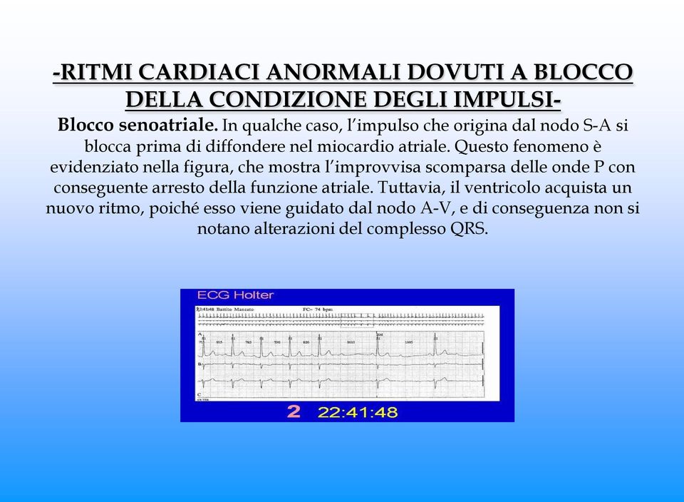 Questo fenomeno è evidenziato nella figura, che mostra l improvvisa scomparsa delle onde P con conseguente arresto della