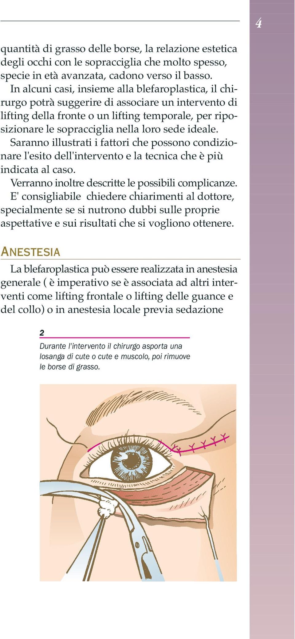 ideale. Saranno illustrati i fattori che possono condizionare l'esito dell'intervento e la tecnica che è più indicata al caso. Verranno inoltre descritte le possibili complicanze.