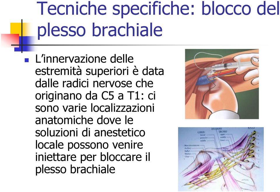 T1: ci sono varie localizzazioni anatomiche dove le soluzioni di