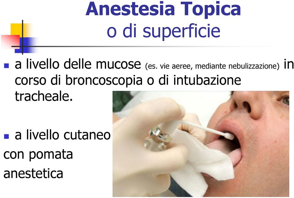 vie aeree, mediante nebulizzazione) in corso di