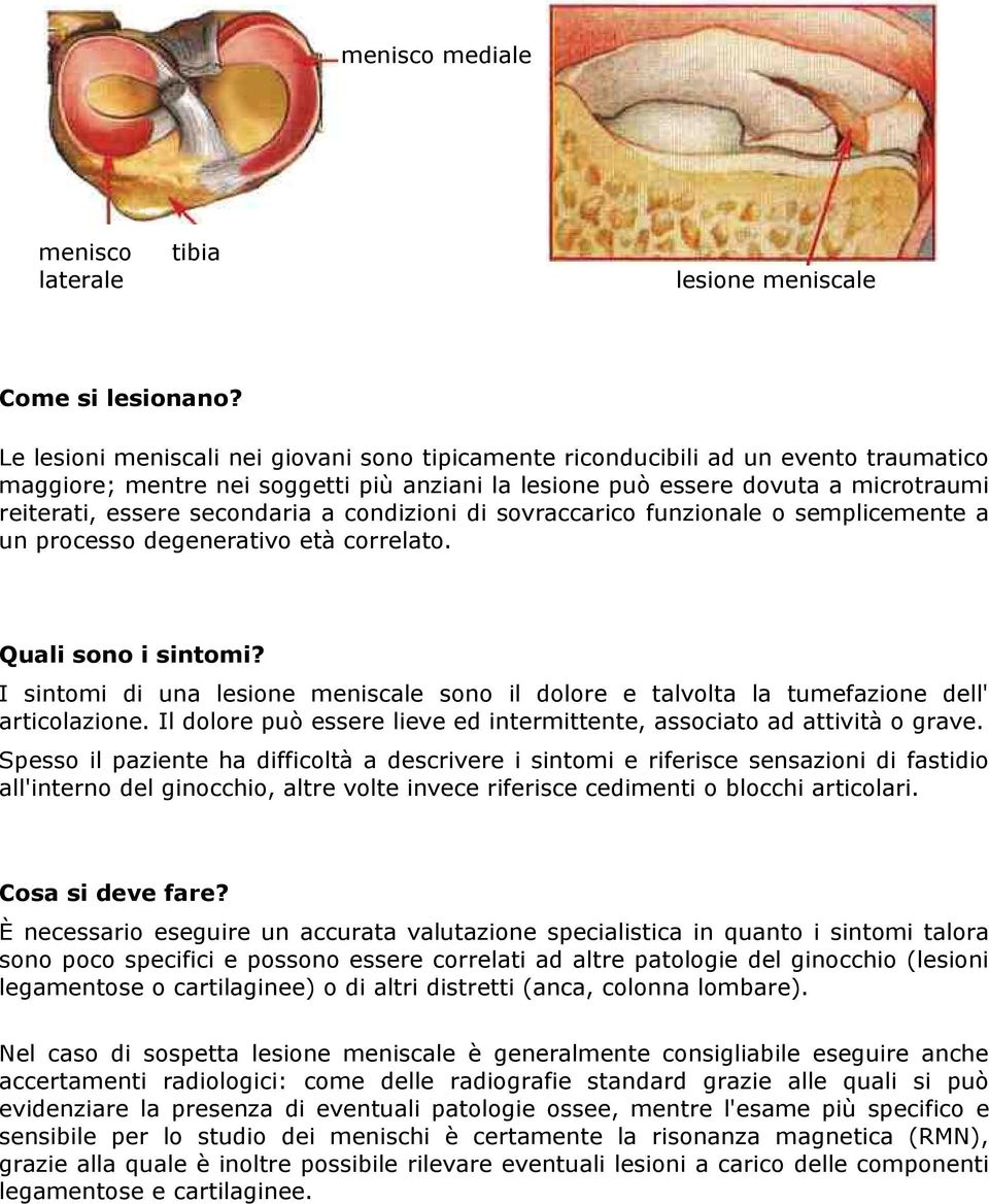 secondaria a condizioni di sovraccarico funzionale o semplicemente a un processo degenerativo età correlato. Quali sono i sintomi?