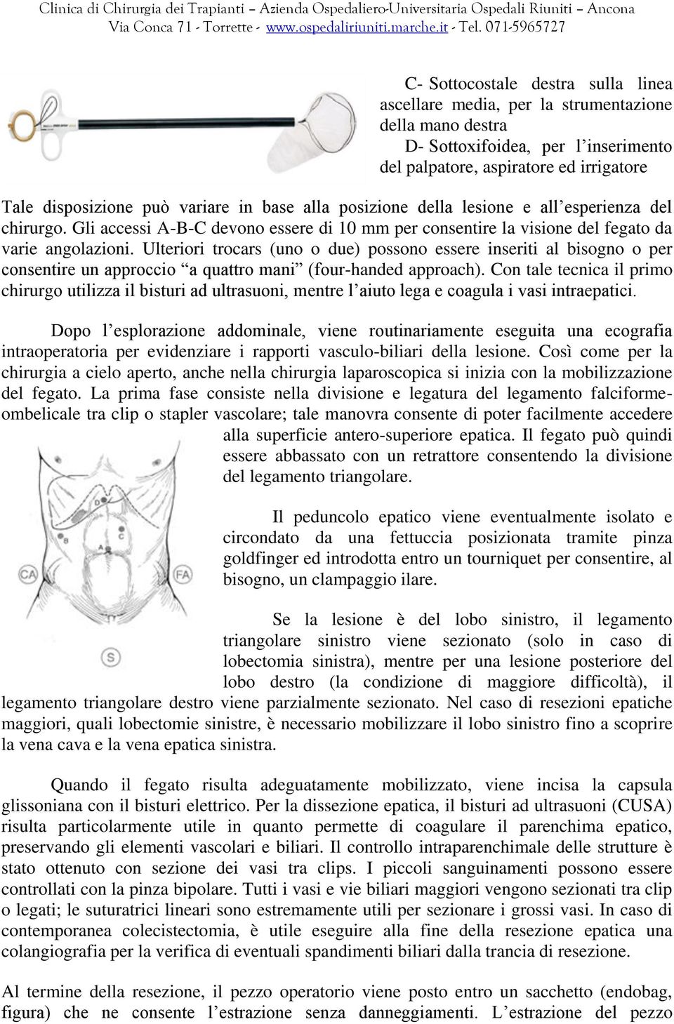 Ulteriori trocars (uno o due) possono essere inseriti al bisogno o per consentire un approccio a quattro mani (four-handed approach).