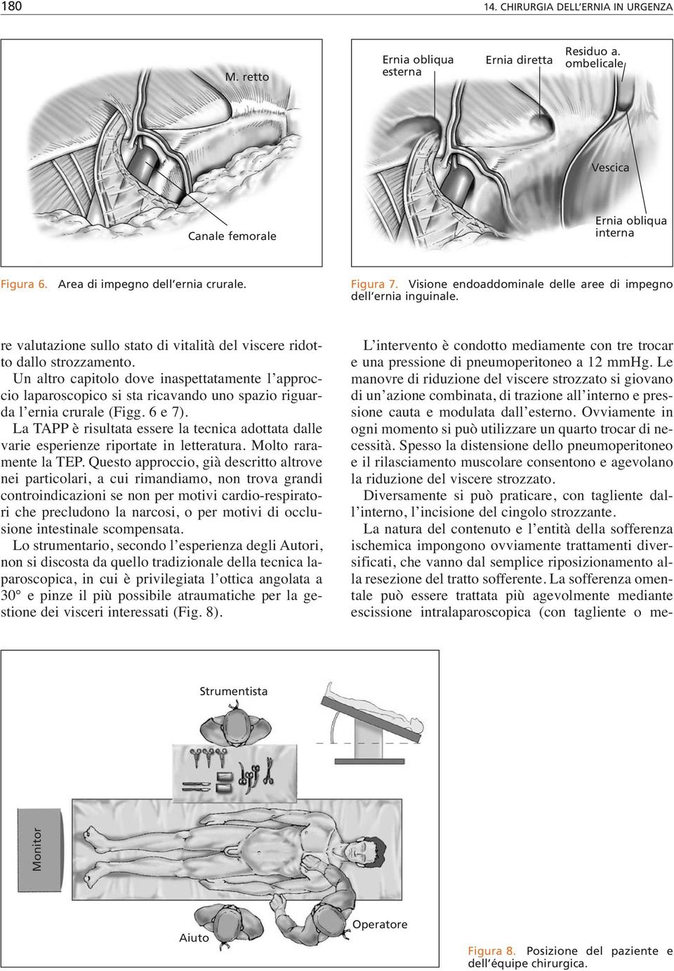 Un altro capitolo dove inaspettatamente l approccio laparoscopico si sta ricavando uno spazio riguarda l ernia crurale (Figg. 6 e 7).