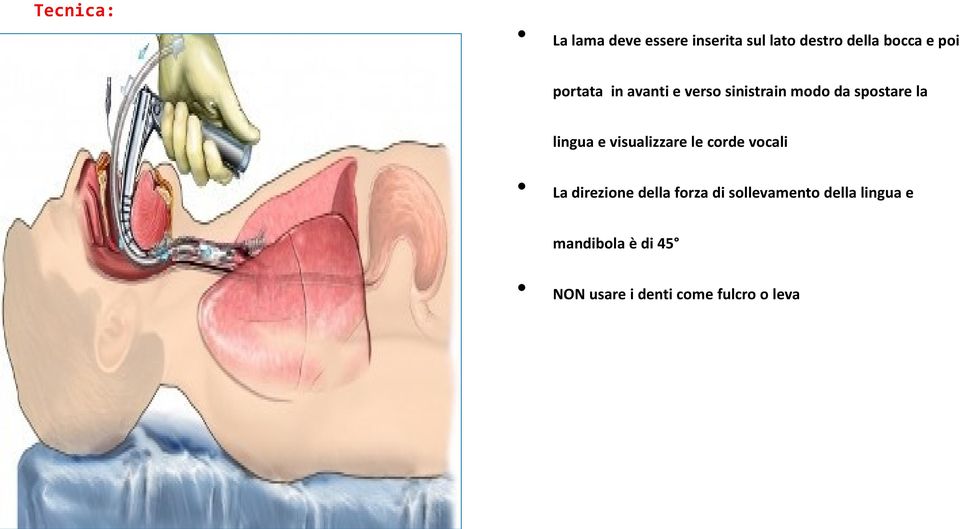 visualizzare le corde vocali La direzione della forza di sollevamento