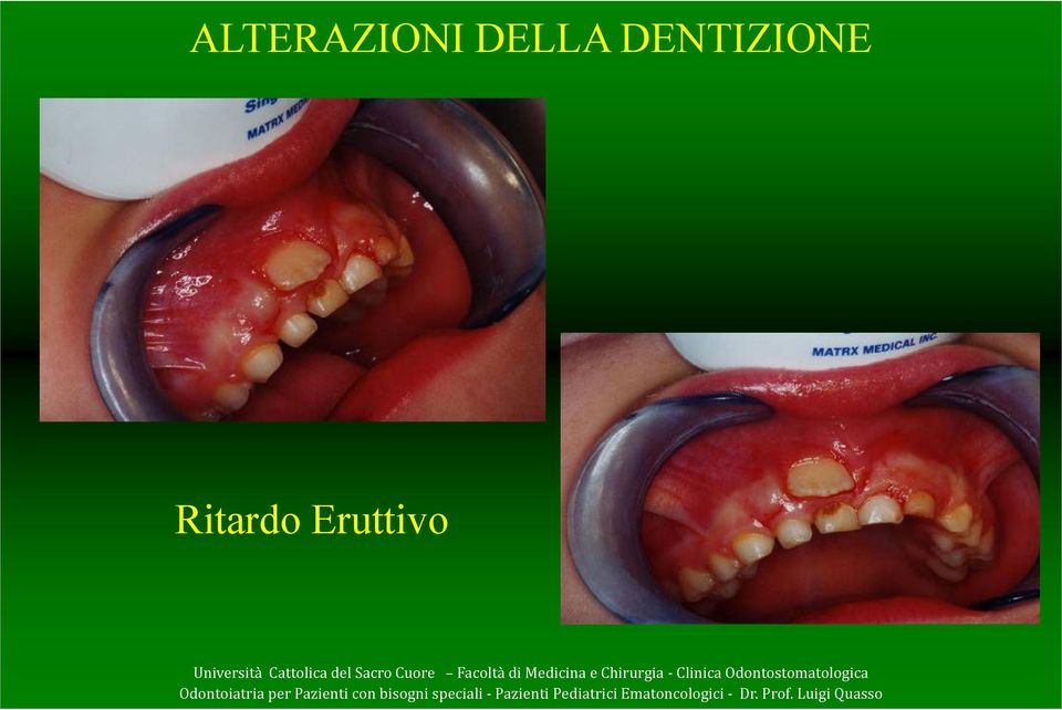 DENTIZIONE