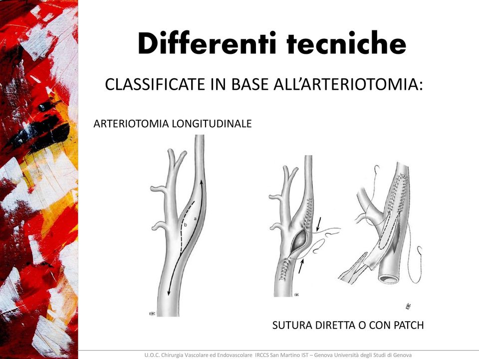 ARTERIOTOMIA: ARTERIOTOMIA