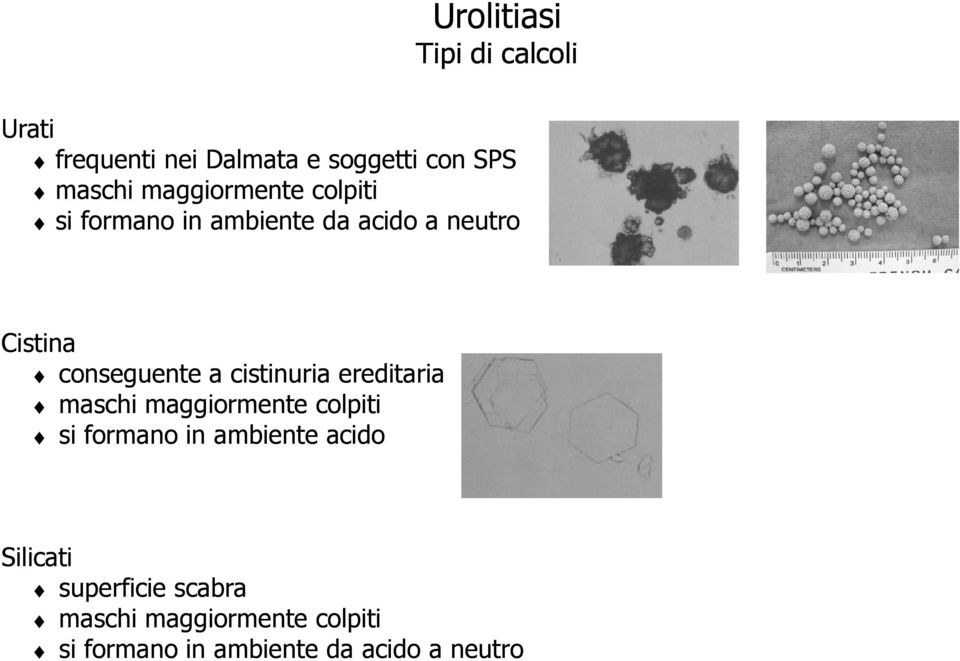 cistinuria ereditaria maschi maggiormente colpiti si formano in ambiente acido