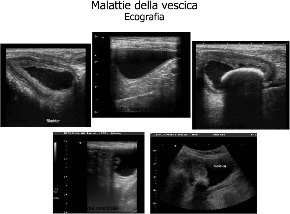 cistite e urolitiasi Cn poliposi