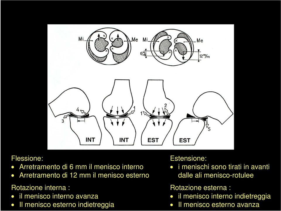 esterno indietreggia Estensione: i menischi sono tirati in avanti dalle ali