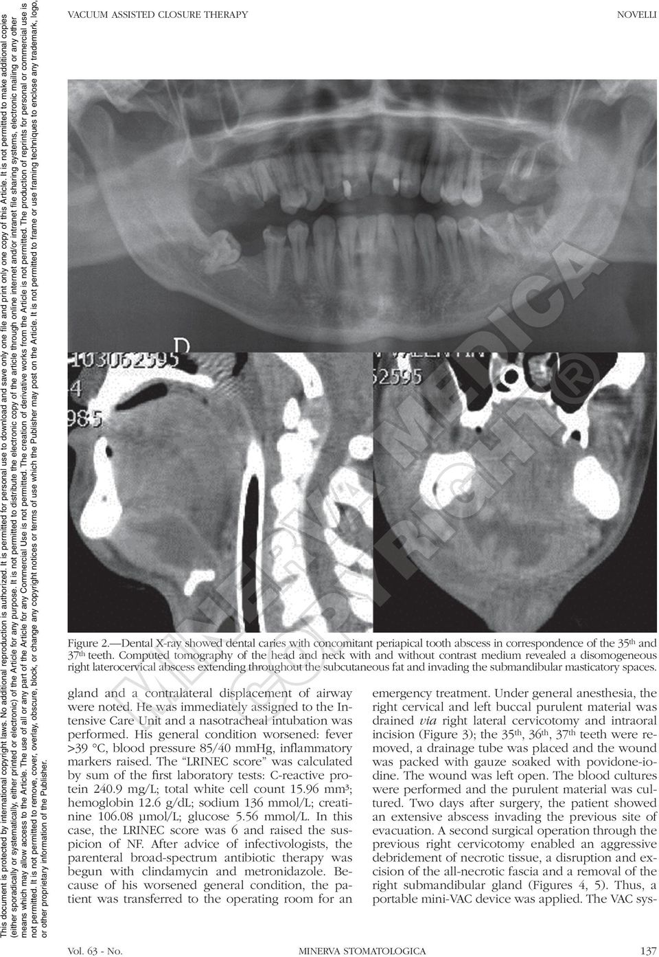 submandibular masticatory spaces. emergency treatment.