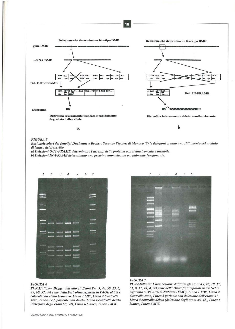 enlamente deeta, senrlfunzionante b FGURA 5 Basi molecolari dei fenotipi Duchenne e Becker. Secondo l'ipotesi di Monaco (7) le delezioni creano uno slittamento del modulo di lettura del trascritto.