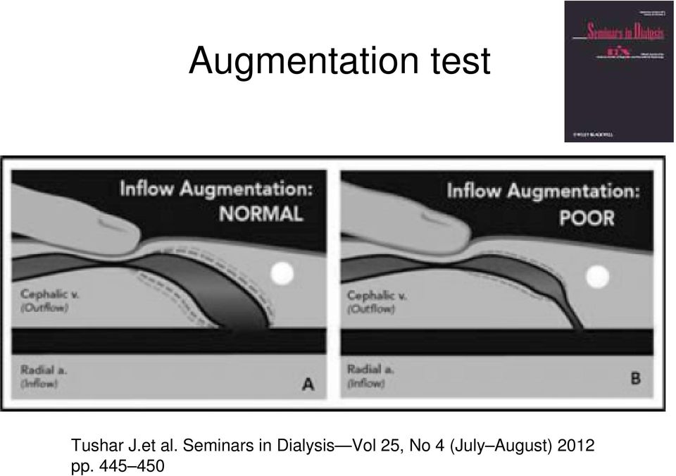 Seminars in Dialysis Vol