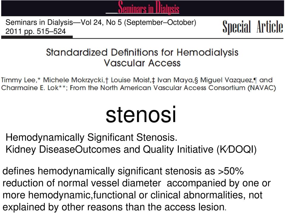 Kidney DiseaseOutcomes and Quality Initiative (K DOQI) defines hemodynamically significant