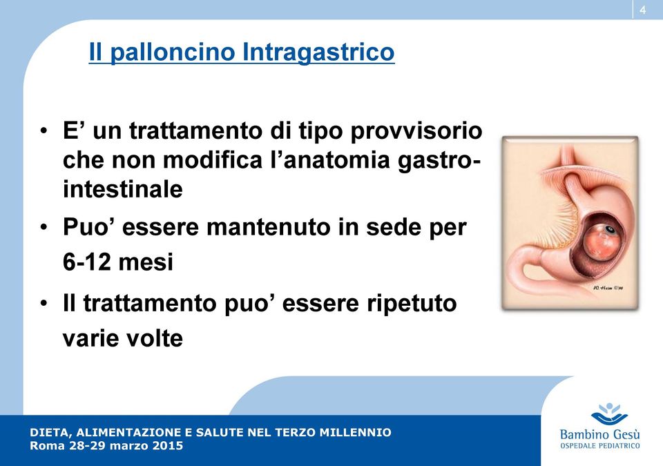 gastrointestinale Puo essere mantenuto in sede per