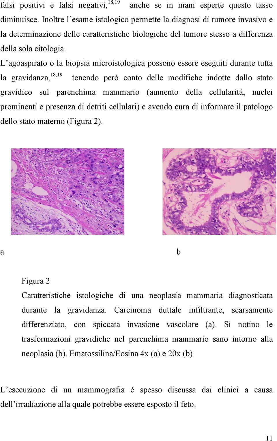 L agoaspirato o la biopsia microistologica possono essere eseguiti durante tutta la gravidanza, 18,19 tenendo però conto delle modifiche indotte dallo stato gravidico sul parenchima mammario (aumento