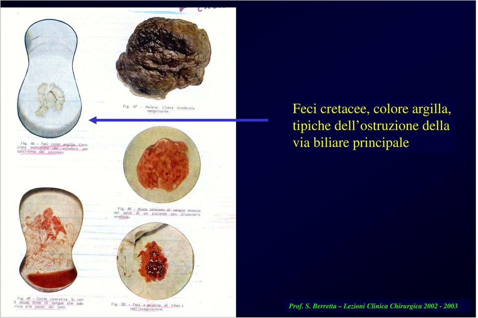 biliare principale Prof. S.