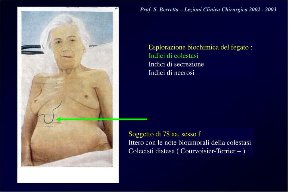 biochimica del fegato : Indici di colestasi Indici di secrezione