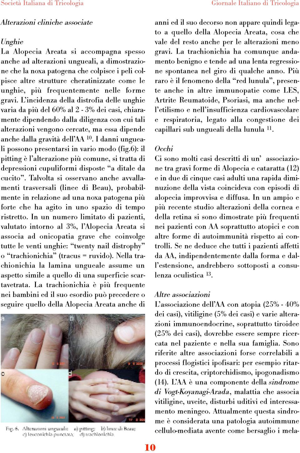 L incidenza della distrofia delle unghie varia da più del 60% al 2-3% dei casi, chiaramente dipendendo dalla diligenza con cui tali alterazioni vengono cercate, ma essa dipende anche dalla gravità