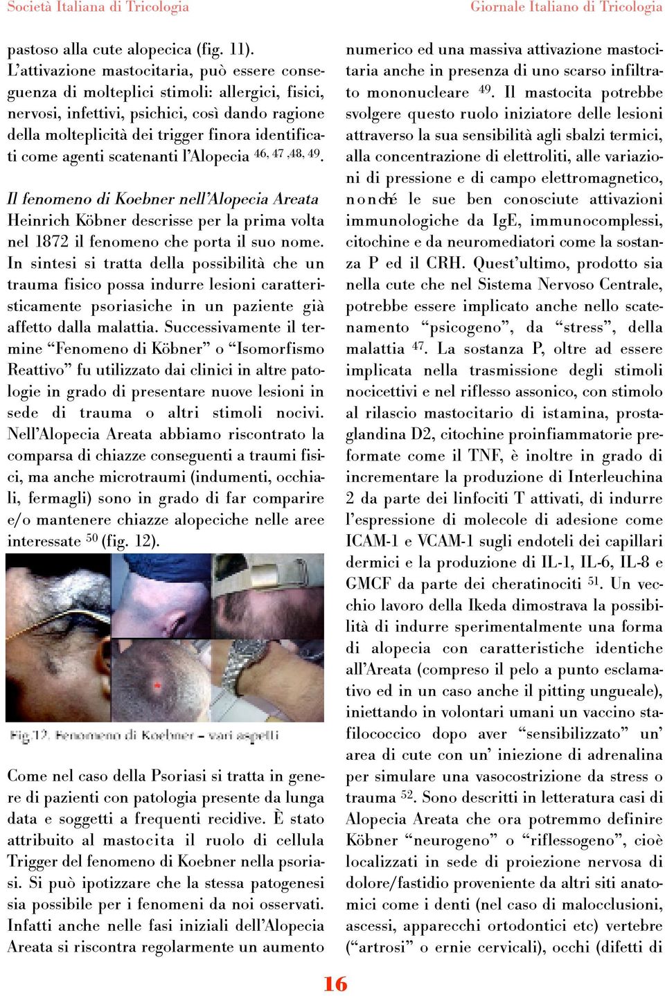 agenti scatenanti l Alopecia 46, 47,48, 49. Il fenomeno di Koebner nell Alopecia Areata Heinrich Köbner descrisse per la prima volta nel 1872 il fenomeno che porta il suo nome.