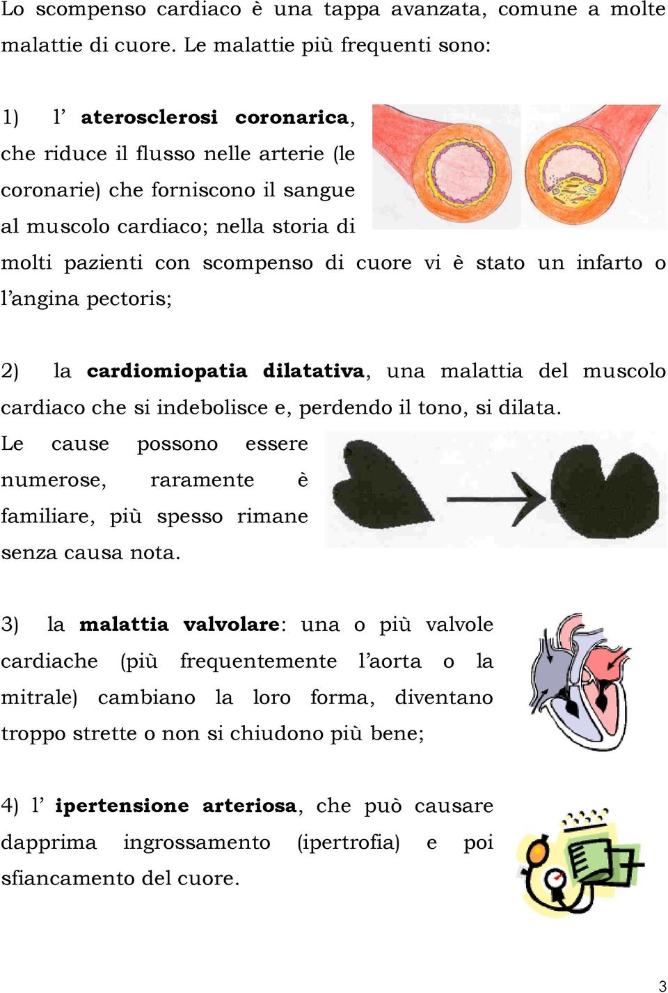 scompenso di cuore vi è stato un infarto o l angina pectoris; 2) la cardiomiopatia dilatativa, una malattia del muscolo cardiaco che si indebolisce e, perdendo il tono, si dilata.