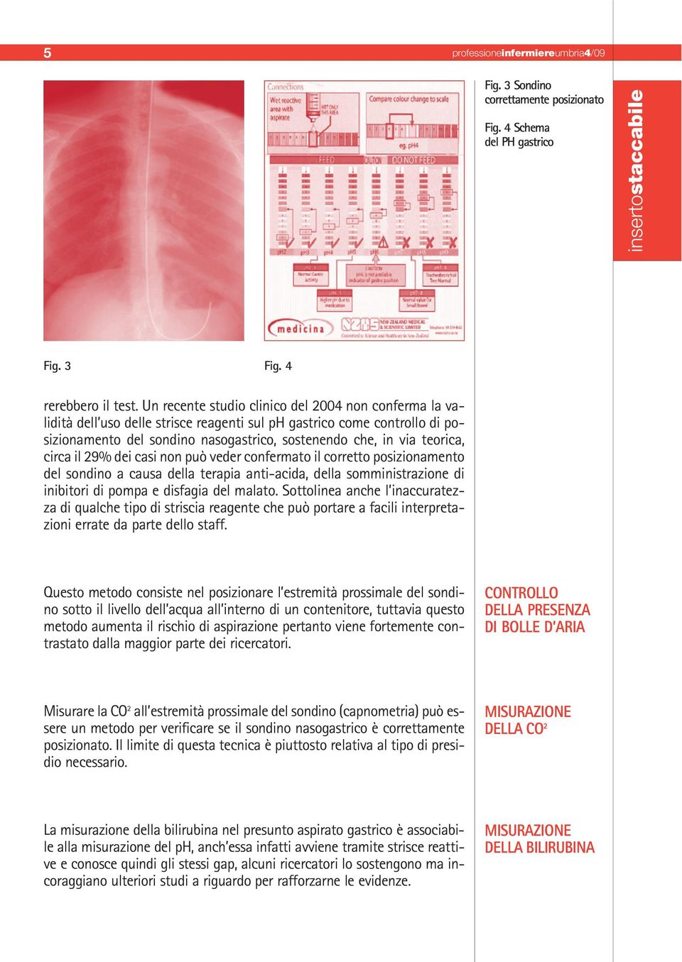 circa il 29% dei casi non può veder confermato il corretto posizionamento del sondino a causa della terapia anti-acida, della somministrazione di inibitori di pompa e disfagia del malato.