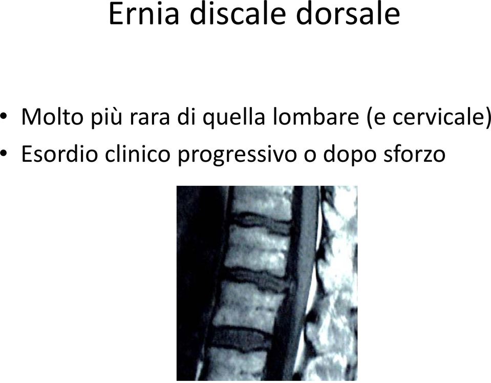 (e cervicale) Esordio