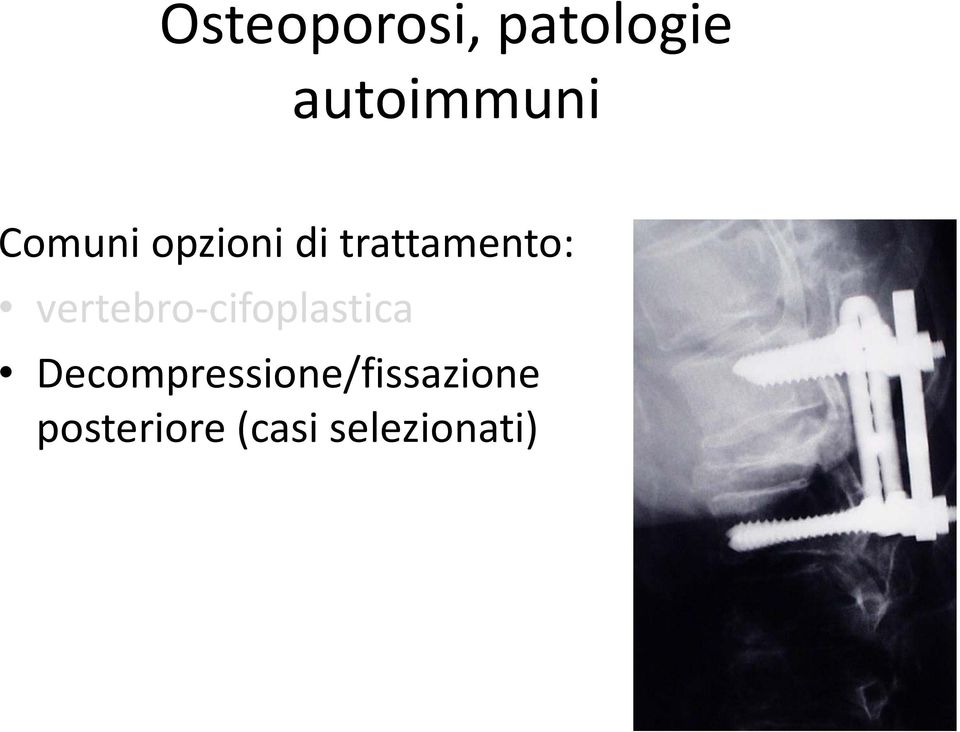 vertebro-cifoplastica
