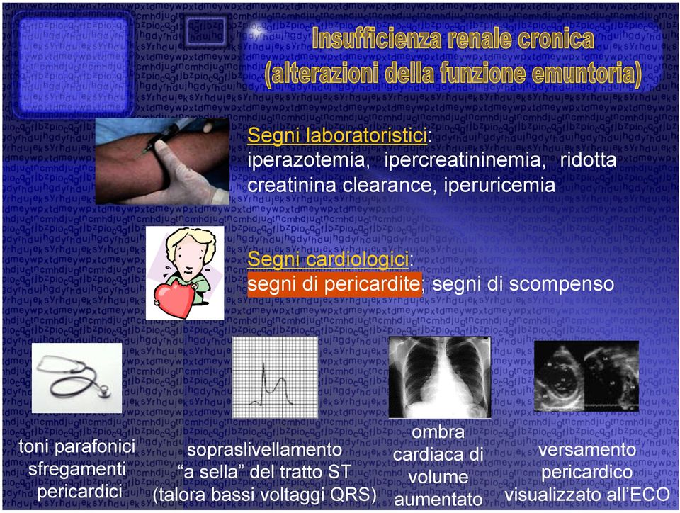 parafonici sopraslivellamento cardiaca di sfregamenti a sella del tratto ST volume