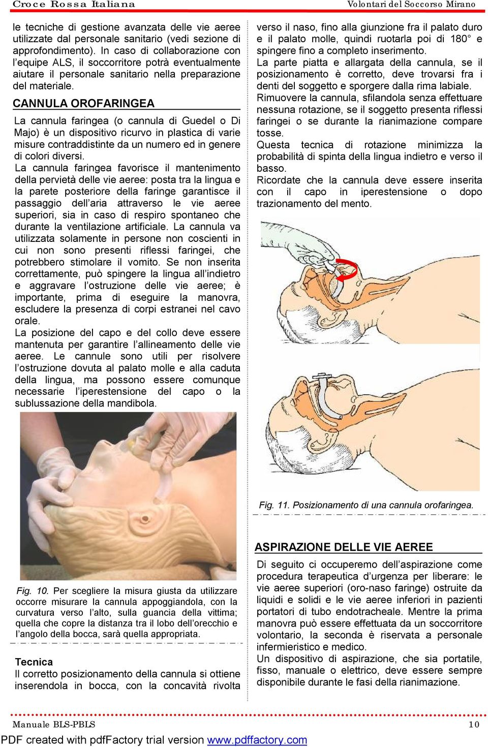 CANNULA OROFARINGEA La cannula faringea (o cannula di Guedel o Di Majo) è un dispositivo ricurvo in plastica di varie misure contraddistinte da un numero ed in genere di colori diversi.