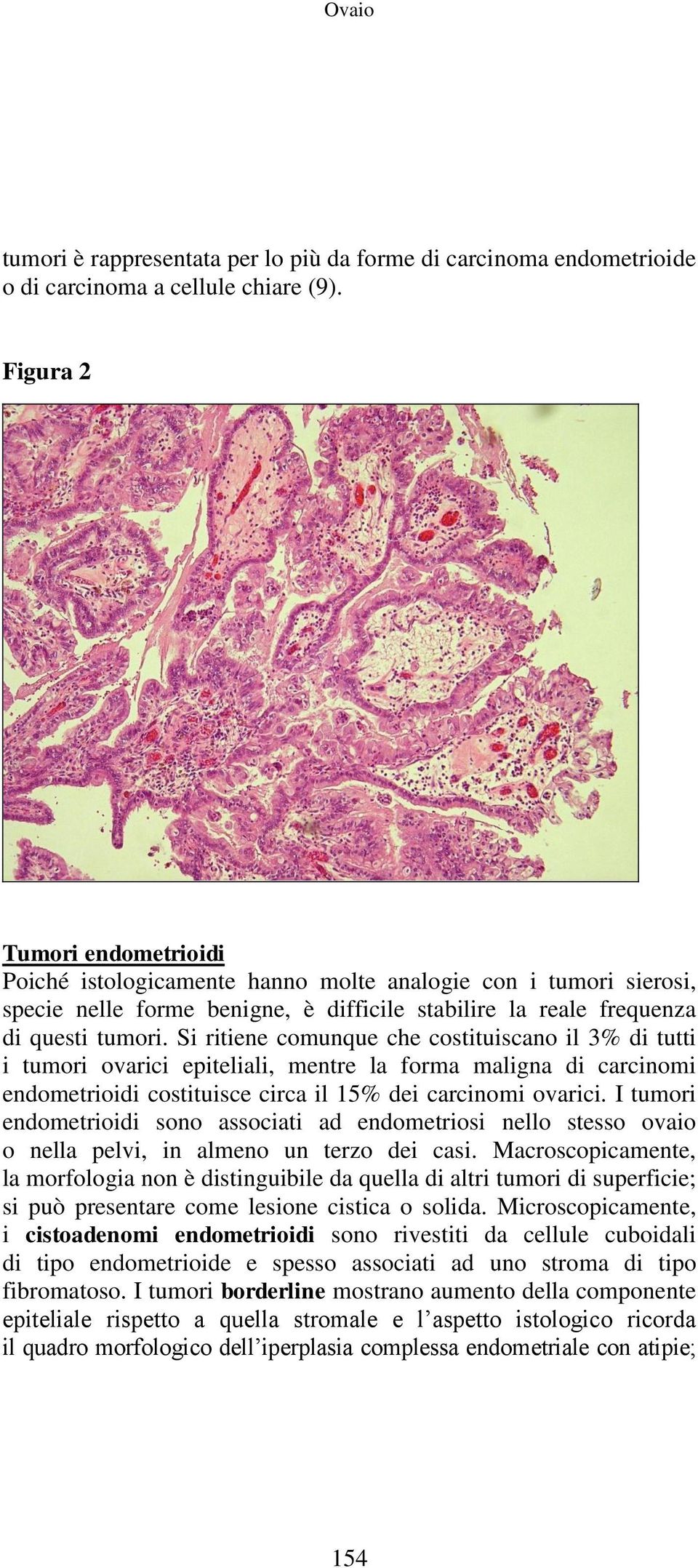 Si ritiene comunque che costituiscano il 3% di tutti i tumori ovarici epiteliali, mentre la forma maligna di carcinomi endometrioidi costituisce circa il 15% dei carcinomi ovarici.