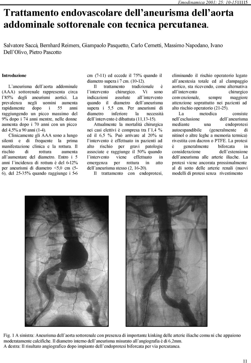 rappresenta circa l 85% degli aneurismi aortici.