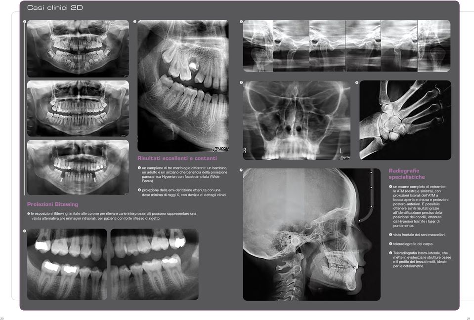 interprossimali possono rappresentare una valida alternativa alle immagini intraorali, per pazienti con forte riflesso di rigetto Radiografie specialistiche un esame completo di entrambe le ATM