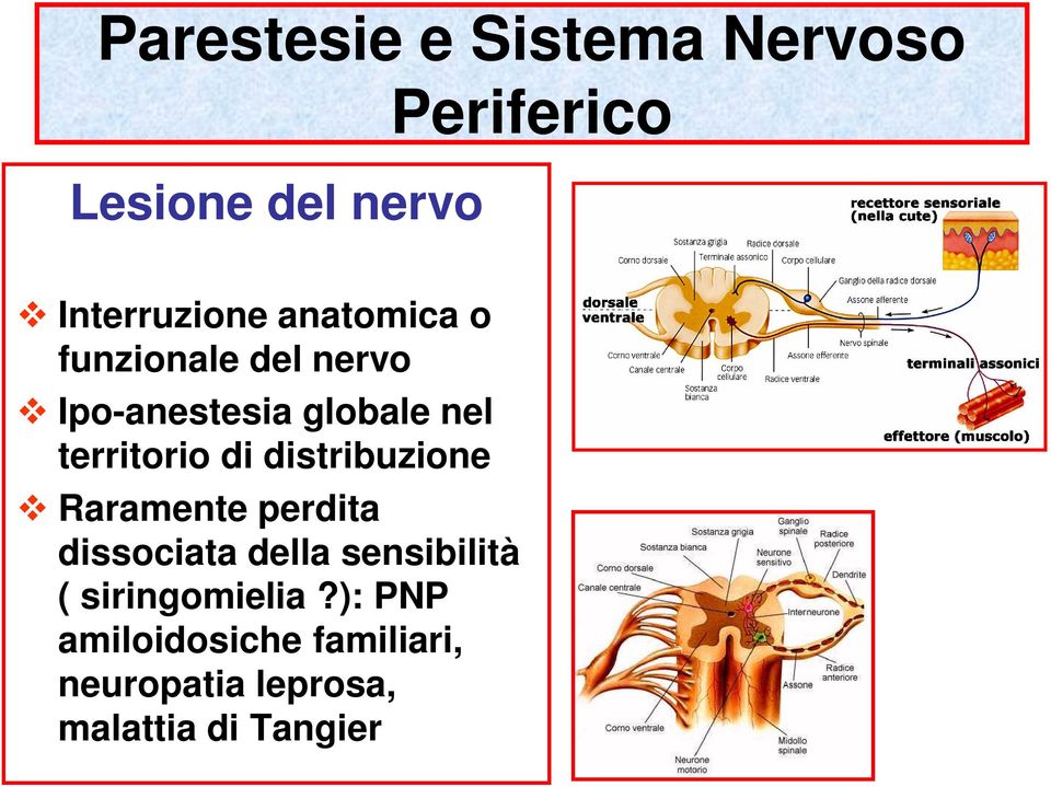 distribuzione Raramente perdita dissociata della sensibilità (