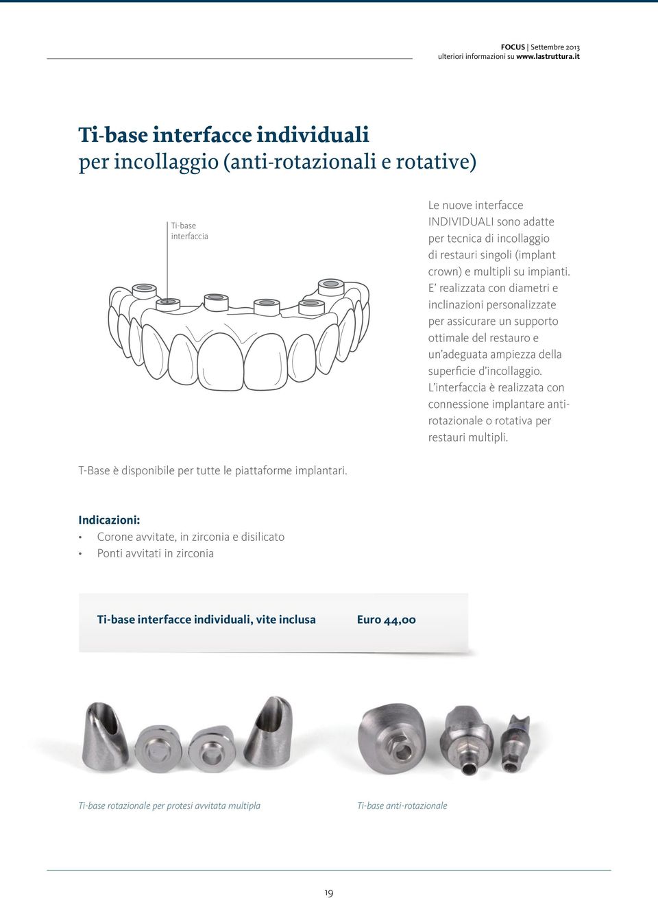 crown) e multipli su impianti. E realizzata con diametri e inclinazioni personalizzate per assicurare un supporto ottimale del restauro e un adeguata ampiezza della superficie d incollaggio.