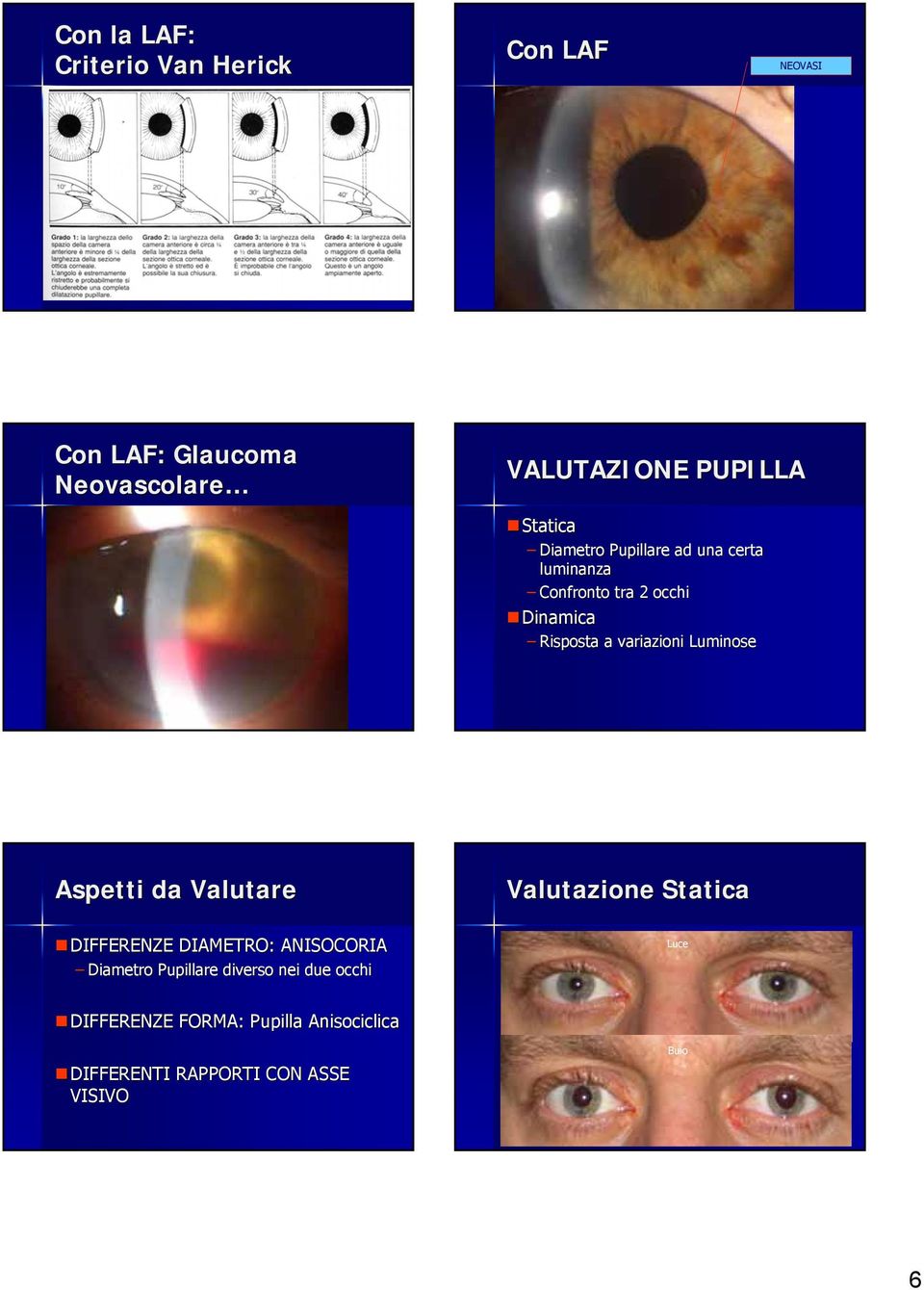 Luminose Aspetti da Valutare DIFFERENZE DIAMETRO: ANISOCORIA Diametro Pupillare diverso nei due occhi